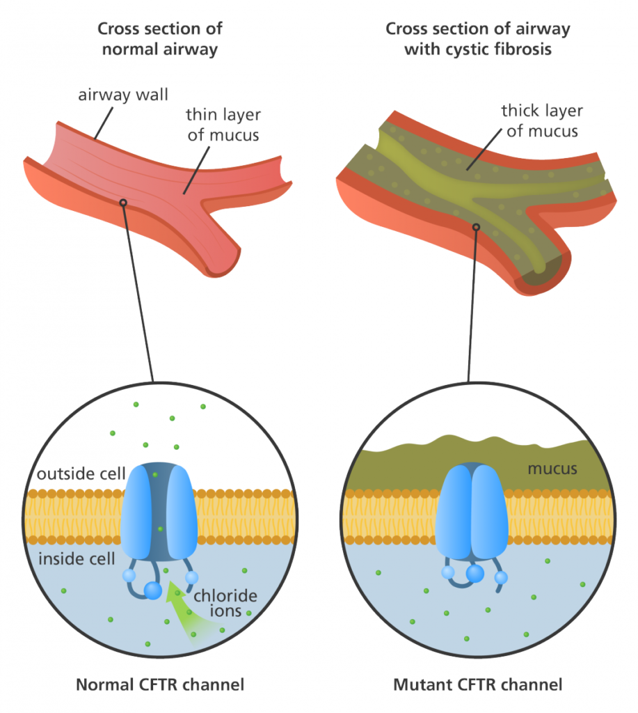 Molecular and genetic basis of cystic fibrosis. Molecular and genetic basis of cystic fibrosis.