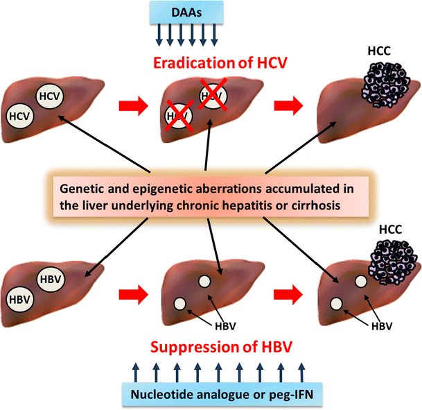 Genetic basis and pathway of hepatitis. Genetic basis and pathway of hepatitis.